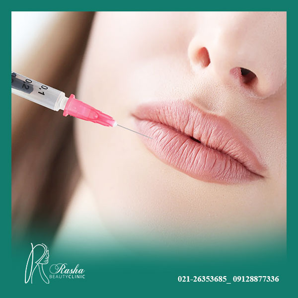 مراقبت بعد از تزریق ژل لب