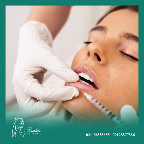 ماندگاری ژل لب چقدر است؟