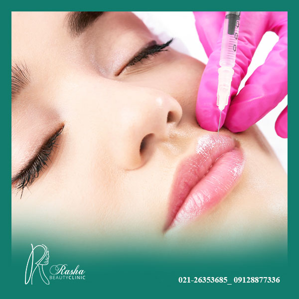 تزریق ژل لب