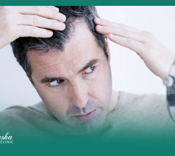 درمان ریزش مو
