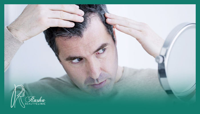 درمان ریزش مو