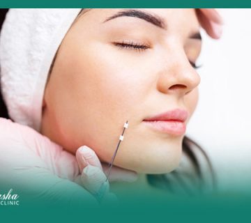 لیفت صورت با نخ