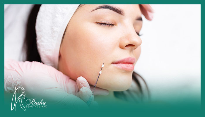 لیفت صورت با نخ