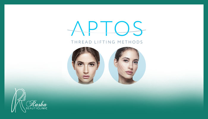لیفت صورت با نخ آپتوس