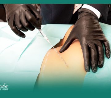 فیلربادی چیست